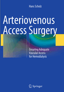 Arteriovenous Access Surgery: Ensuring Adequate Vascular Access for Hemodialysis