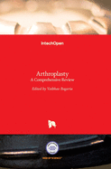 Arthroplasty: A Comprehensive Review