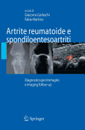 Artrite Reumatoide E Spondiloentesoartriti: Diagnostica Per Immagini Ed Imaging Follow-Up