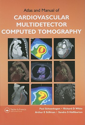 Atlas and Manual of Cardiovascular Multidetector Computed Tomography - Schoenhagen, Paul, M.D., and Stillman, Arthur E, and Halliburton, Sandra S