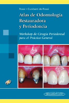 Atlas de Odontologia Restauradora y Periodoncia: Workshop de Cirugia Periodontal Para el Practico General - Rossi, Guillermo Horacio, and Cuniberti De Rossi, Nelida Elena