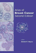 Atlas of Breast Cancer - Hayes, Daniel F, MD