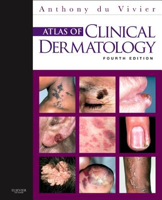 Atlas of Clinical Dermatology - Du Vivier, Anthony
