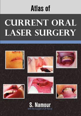 Atlas of Current Oral Laser Surgery - Namour, S