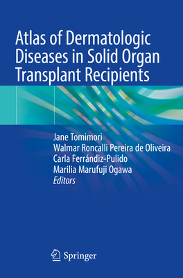 Atlas of Dermatologic Diseases in Solid Organ Transplant Recipients - Tomimori, Jane (Editor), and Oliveira, Walmar Roncalli Pereira de (Editor), and Ferrndiz-Pulido, Carla (Editor)