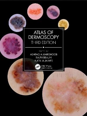 Atlas of Dermoscopy: Third Edition - Marghoob, Ashfaq A (Editor), and Braun, Ralph (Editor), and Jaimes, Natalia (Editor)