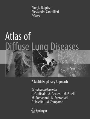 Atlas of Diffuse Lung Diseases: A Multidisciplinary Approach - Dalpiaz, Giorgia (Editor), and Cancellieri, Alessandra (Editor)
