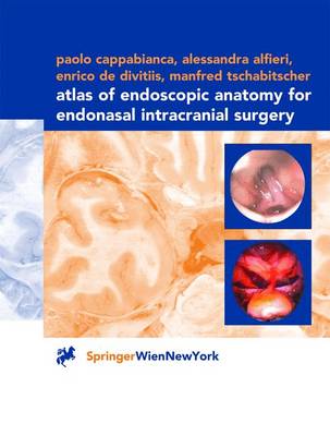 Atlas of Endoscopic Anatomy for Endonasal Intracranial Surgery - Cappabianca, Paolo, and Alfieri, Alessandra, and Divitiis, Enrico de