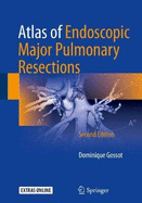 Atlas of Endoscopic Major Pulmonary Resections