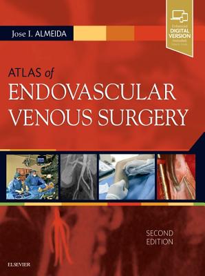 Atlas of Endovascular Venous Surgery - Almeida, Jose, MD, Pa