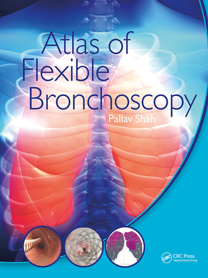 Atlas of Flexible Bronchoscopy - Shah, Pallav