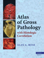 Atlas of Gross Pathology: With Histologic Correlation - Rose, Alan G