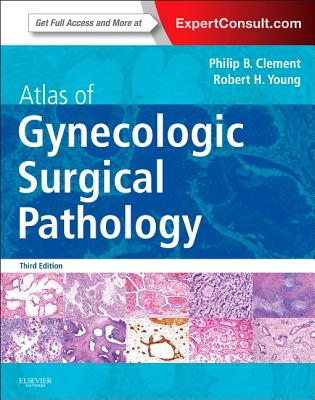 Atlas of Gynecologic Surgical Pathology: Expert Consult: Online and Print - Clement, Philip B, MD, and Young, Robert H, MD