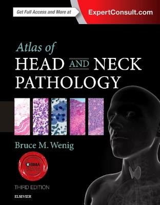 Atlas of Head and Neck Pathology - Wenig, Bruce M, MD