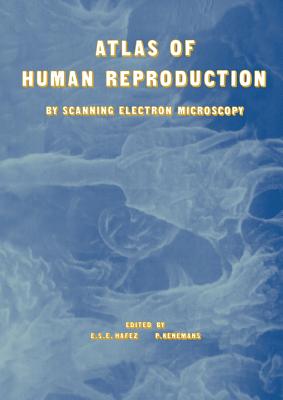 Atlas of Human Reproduction: By Scanning Electron Microscopy - Hafez, E S, and Kenemans, P