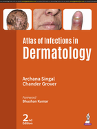 Atlas of Infections in Dermatology