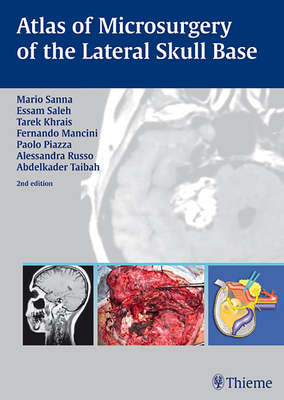 Atlas of Microsurgery of the Lateral Skull Base - Sanna, Mario, and Khrais, Tarek, and Mancini, Fernando