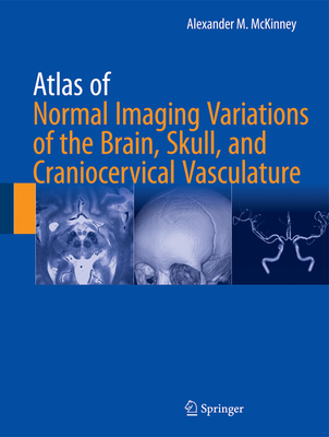 Atlas of Normal Imaging Variations of the Brain, Skull, and Craniocervical Vasculature - McKinney, Alexander M