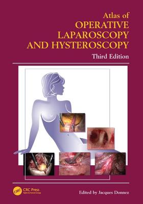 Atlas of Operative Laparoscopy and Hysteroscopy - Donnez, Jacques, MD, PhD (Editor)