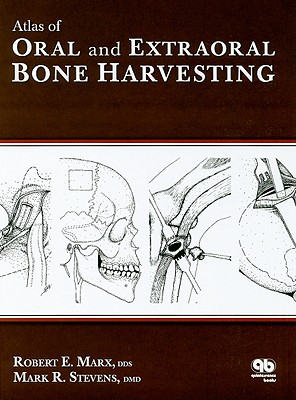 Atlas of Oral and Extraoral Bone Harvesting - Marx, Robert E