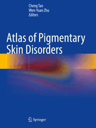 Atlas of Pigmentary Skin Disorders