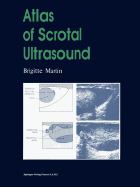 Atlas of Scrotal Ultrasound - Martin, Brigitte, and Hricak, H. (Preface by)