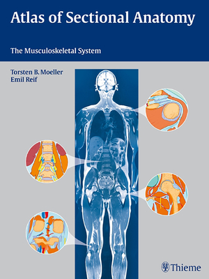 Atlas of Sectional Anatomy: The Musculoskeletal System - Mller, Torsten Bert, and Reif, Emil