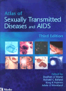 Atlas of sexually transmitted diseases and AIDS