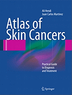 Atlas of Skin Cancers: Practical Guide to Diagnosis and Treatment