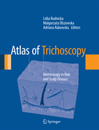 Atlas of Trichoscopy: Dermoscopy in Hair and Scalp Disease