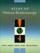 Atlas of Vitreous Biomicroscopy - Schepens, Charles L, and Takahashi, Masataka, MD, and Trempe, Clement L, MD