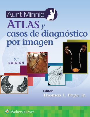 Aunt Minnie. Atlas Y Casos de Diagnstico Por Imagen - Pope Jr, Thomas L, MD