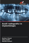 Ausili radiografici in implantologia