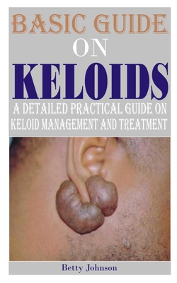 Basic Guide on Keloids: A detailed practical guide on keloid management and treatment - Johnson, Betty