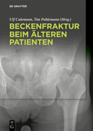 Beckenfraktur beim ?lteren Patienten