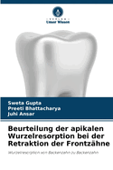 Beurteilung der apikalen Wurzelresorption bei der Retraktion der Frontz?hne