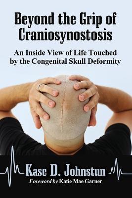 Beyond the Grip of Craniosynostosis: An Inside View of Life Touched by the Congenital Skull Deformity - Johnstun, Kase D