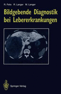 Bildgebende Diagnostik Bei Lebererkrankungen