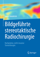 Bildgefhrte stereotaktische Radiochirurgie: Hochprzise, nicht-invasive Tumortherapie