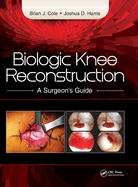 Biologic Knee Reconstruction: A Surgeon's Guide
