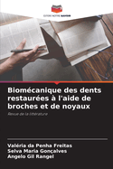 Biom?canique des dents restaur?es ? l'aide de broches et de noyaux