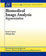 Biomedical Image Analysis: Segmentation