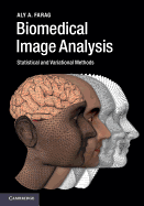Biomedical Image Analysis: Statistical and Variational Methods