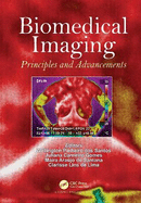 Biomedical Imaging: Principles and Advancements