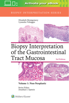 Biopsy Interpretation of the Gastrointestinal Tract Mucosa: Volume 1: Non-Neoplastic - Montgomery, Elizabeth A., and Voltaggio, Lysandra