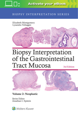 Biopsy Interpretation of the Gastrointestinal Tract Mucosa: Volume 2: Neoplastic - Montgomery, Elizabeth A., and Voltaggio, Lysandra
