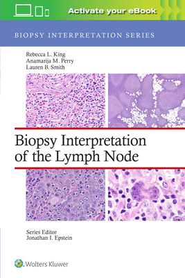 Biopsy Interpretation of the Lymph Node: Print + eBook with Multimedia - King, Rebecca Leigh, MD, and Perry, Anamarija M, MD, and Smith, Lauren B, MD