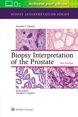 Biopsy Interpretation of the Prostate - Epstein, Jonathan I