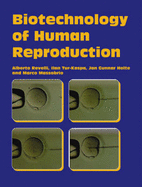 Biotechnology of Human Reproduction