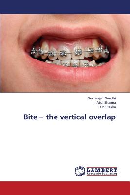 Bite - The Vertical Overlap - Gandhi Geetanjali, and Sharma Atul, and Kalra J P S